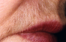 Hair above upper lip